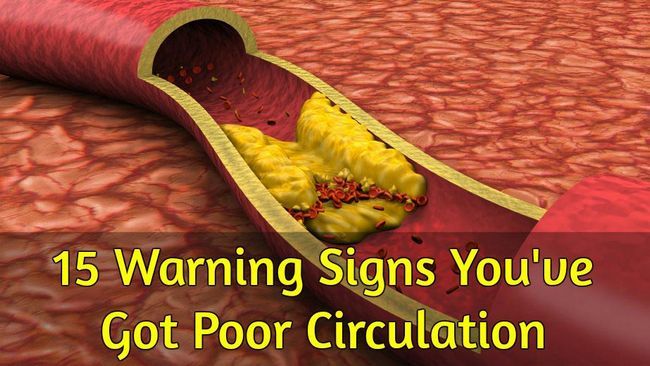 15 señales de advertencia You`ve Got Poor Circulation
