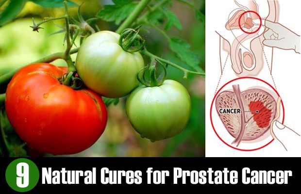 9 curas naturales para el cáncer de próstata