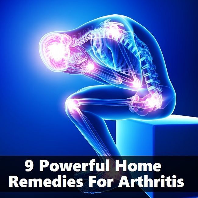 9 Potentes Remedios caseros para la artritis