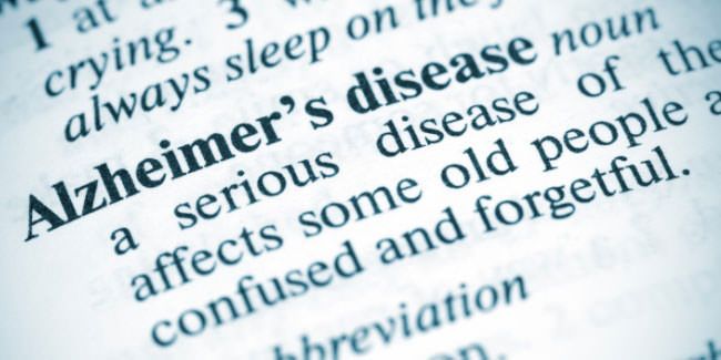 Alzheimer`s Disease Causes Symptoms and Treatment