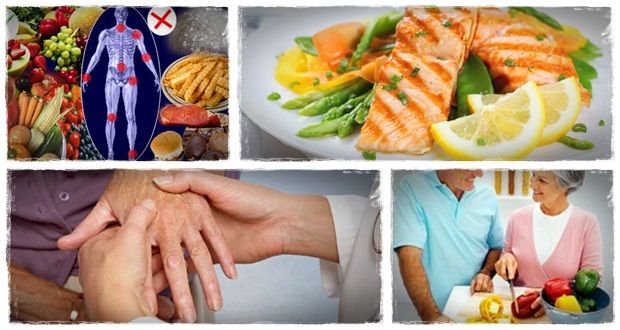 Alimentos para dolor de la artritis