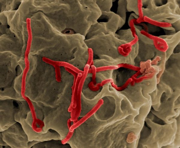 Micrografía electrónica de barrido de virus de Ébola en ciernes de la superficie de una célula Vero (African línea de células epiteliales de riñón de mono verde).