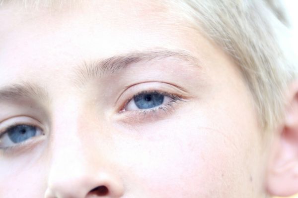 Las ojeras Buster: la vitamina K y el trabajo de árnica juntos por una piel radiante