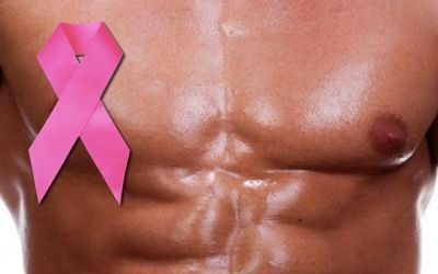El cáncer de mama en los hombres pasa por alto