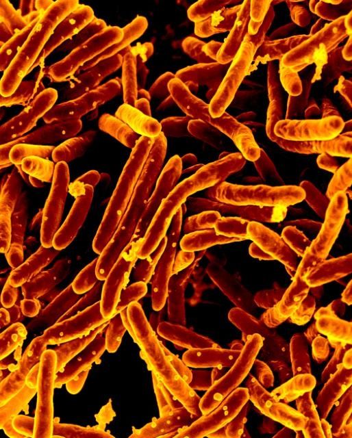 Prueba de aliento que detecta bacteria de la tuberculosis y la resistencia isonaziad desarrollado