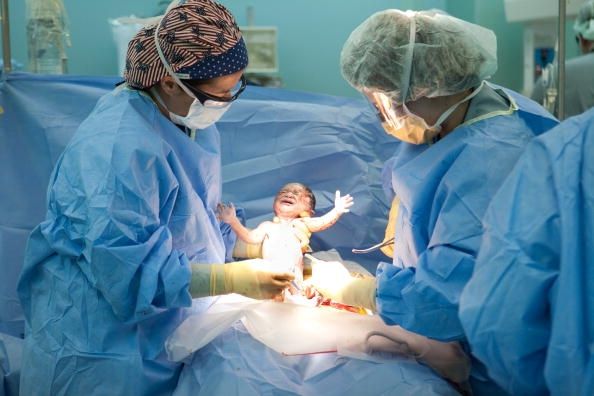 Un bebé nazca por cesárea, lo que podría ser la manera más segura de ir con un bebé de nalgas.