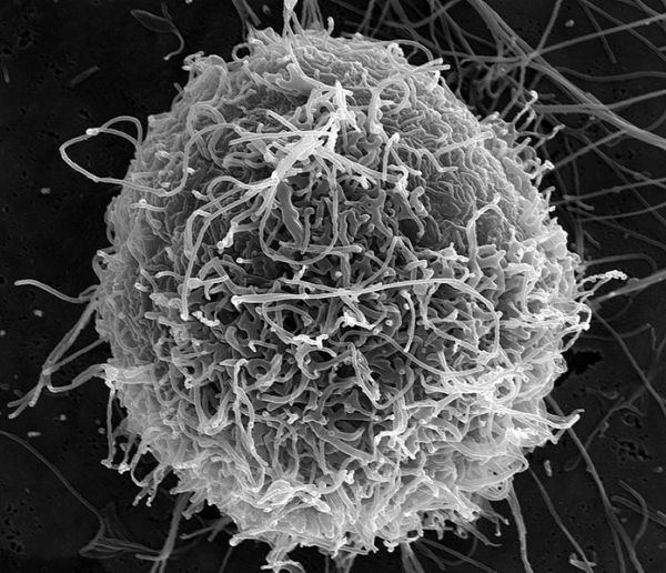 Micrografía electrónica de barrido de partículas de virus Ébola filamentosas en ciernes de una sola célula VERO E6 infectadas crónicamente (25,000x aumentos).