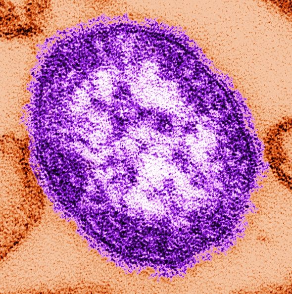 Más de un millar de niños en ontario probablemente expuestos al sarampión