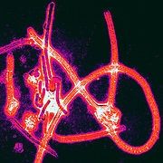 Fragmentos del virus Ébola. El brote en el África occidental continúa.