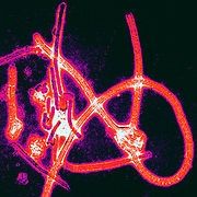 Fragmentos del virus Ébola. Una vacuna contra el Ébola parece prometedor.
