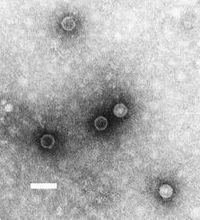 Cuatro años muere de enterovirus 68, CDC dice