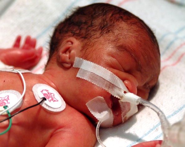 Un bebé prematuro nacido en Alabama.