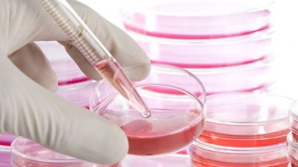 Los científicos han diseñado con éxito cellls madre que se dirigen selectivamente y matan a las células cancerosas en los tumores cerebrales.