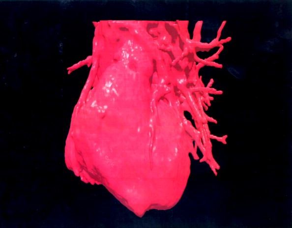 Un tridimensional (3-D) Imagen de un corazón humano