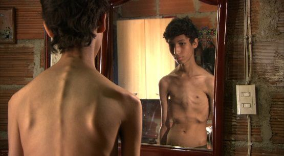 Remedios caseros para la anorexia Tratamiento Naturalmente