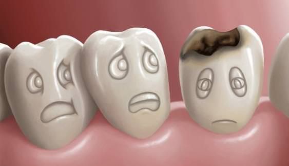Remedios caseros para la caries El dolor y la caries dental