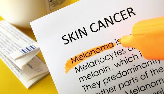 Remedios caseros para el cáncer de piel Tratamiento Naturalmente