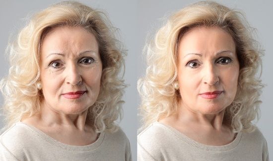 Remedios caseros para las arrugas deshacerse de las arrugas naturalmente