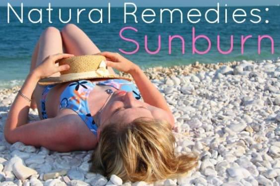 ¿Cómo deshacerse de quemaduras de sol - Remedios Naturales Sunburn