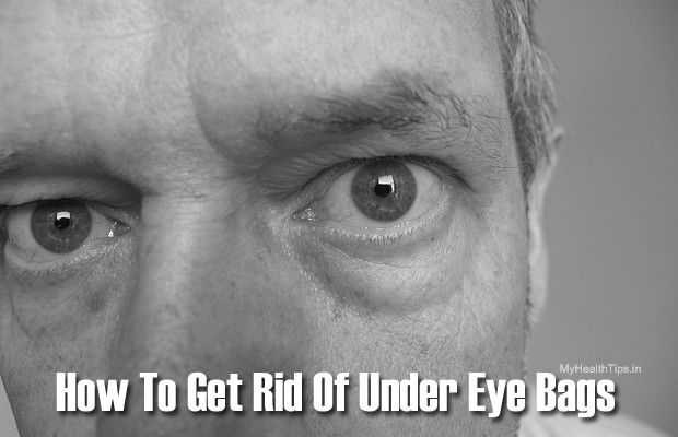 Cómo deshacerse de las bolsas de los ojos bajo