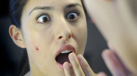 Cómo deshacerse de Zits ayuno nocturno