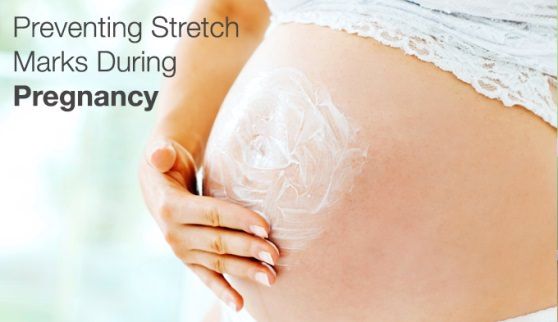 Cómo prevenir las estrías durante el embarazo?