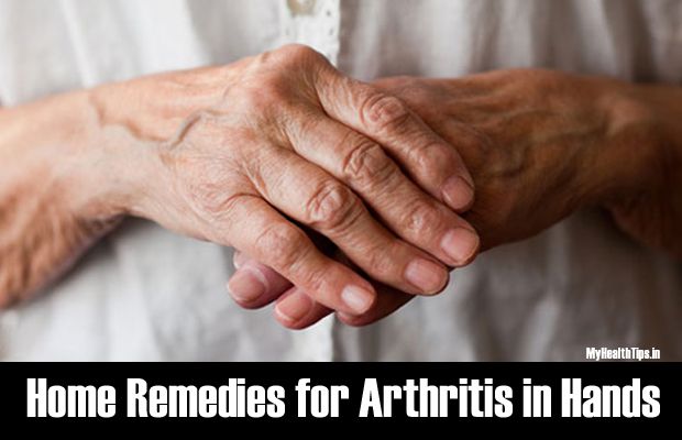 Remedios caseros ideales para tratar la artritis en las manos