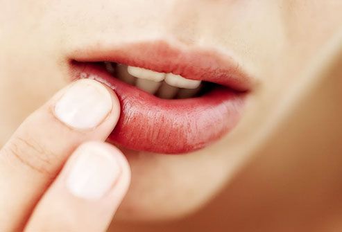 Infecciones de labios y sus curas