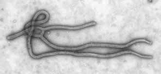 El CDC recibió muchas llamadas sobre posibles casos de ébola en los EE.UU., pero no se encontraron sólo cuatro personas que están infectados.