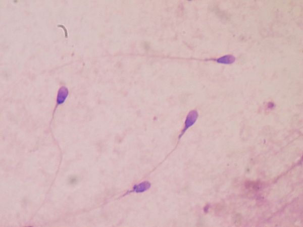 Esperma humano manchado para las pruebas de la calidad del semen en el laboratorio clínico.