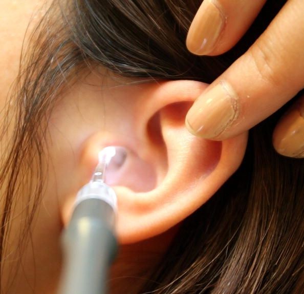 Muchas personas se ven afectadas por el zumbido en los oídos (tinnitus), pero un nuevo tratamiento magnético pueden ayudar.