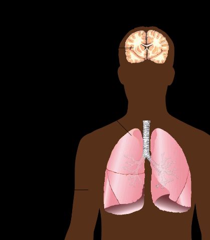 Principales síntomas de la tuberculosis pulmonar, como se describe en la Wikipedia: artículo de la Tuberculosis.