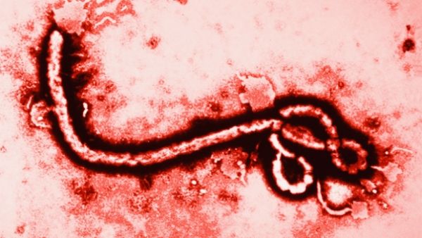 CDC confirma que el paciente en Miami no tiene virus del Ébola.