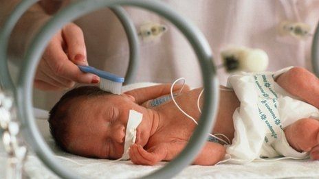 La leche y los suplementos de apoyar el crecimiento prematuro bebé