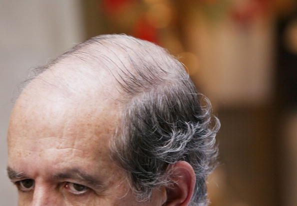 La mayoría de los hombres sufren de caída del cabello: remedios naturales que realmente funcionan