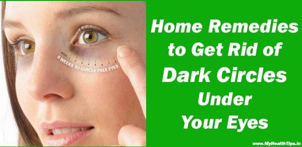 Remedios caseros para deshacerse de los círculos oscuros bajo los ojos