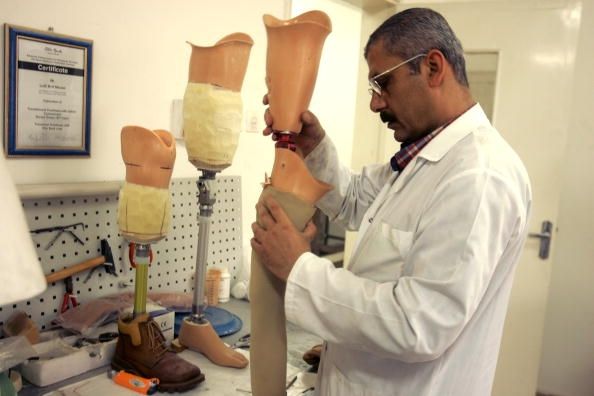 Brazos y piernas artificiales pueden ahora estar en camino después de una`artificial skin` showed natural-like function