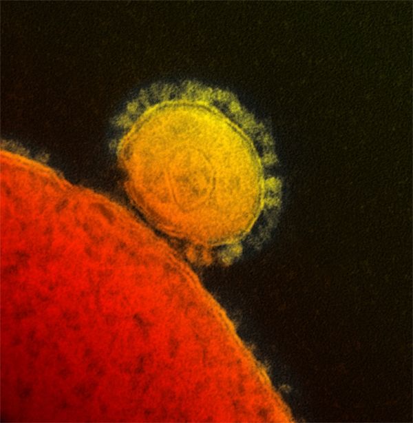Una micrografía electrónica del virus MERS.