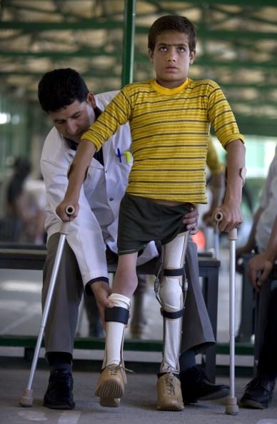 Un niño afgano que tenía poliomielitis está equipado con nuevos aparatos ortopédicos para las piernas. Las bajas tasas de vacunación contra la poliomielitis en los Estados Unidos podrían traer la enfermedad espalda.
