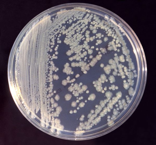 Una placa de Petri de bacterias Enterobacter, la clase que aparecen para hacerse cargo de una pequeña muestra de pacientes con quemaduras.