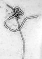 Una micrografía electrónica de una partícula viral de Ébola que muestra la estructura filamentosa característica de un Filoviridae.