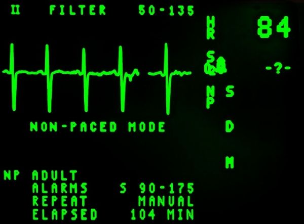 ECG ECG