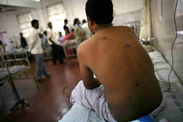 Brote de la gripe porcina: el virus mata a 75 en la India