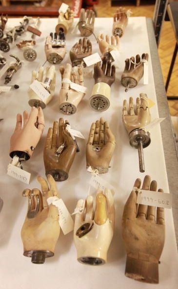 A diferencia de estos antiguos manos protésicas, manos biónicas reconstruidas pueden mover y recoger objetos.