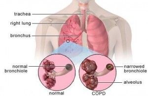 fumar afecta a los pulmones