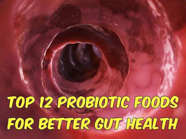Top 12 probióticos Los alimentos para una mejor Salud intestinal