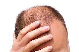 Top 7 ventajas de engrasar el cabello con regularidad