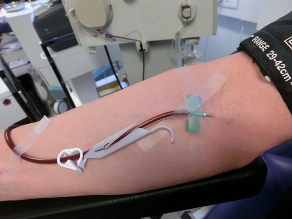 donación de plasma sanguíneo