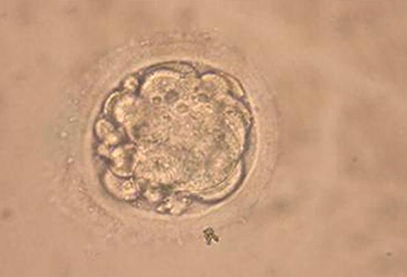 A enbryo humano.