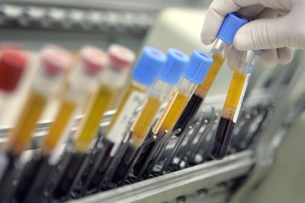 Reino Unido para iniciar un juicio por sangre sintética
